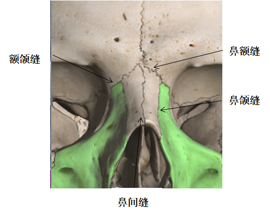 影像PPT - 鼻骨缝的解剖与鼻骨骨折-1 影像PPT - 鼻骨缝的解剖与鼻骨骨折-1