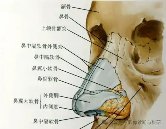 影像PPT - 鼻骨缝的解剖与鼻骨骨折-2 影像PPT - 鼻骨缝的解剖与鼻骨骨折-2