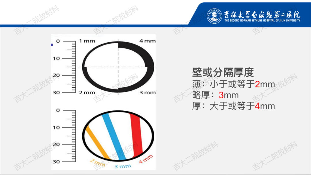 影像PPT - 【PPT】肾脏囊性肿块的Bosniak分级解读（2019版）-13