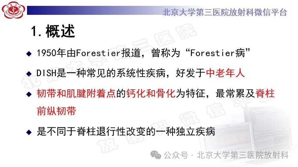 影像PPT - 【PPT】弥漫性特发性骨肥厚症-6