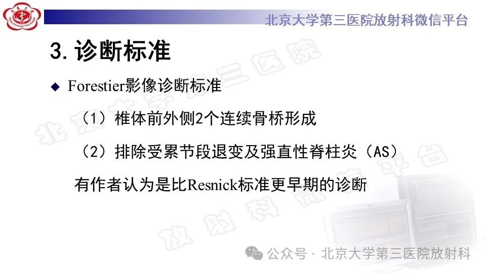 影像PPT - 【PPT】弥漫性特发性骨肥厚症-10