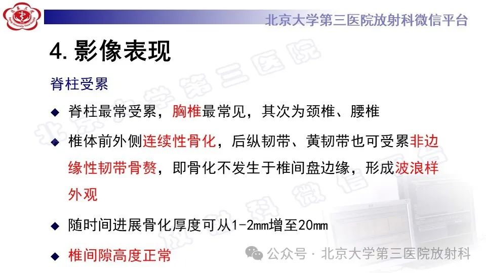 影像PPT - 【PPT】弥漫性特发性骨肥厚症-11