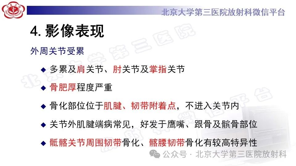 影像PPT - 【PPT】弥漫性特发性骨肥厚症-12