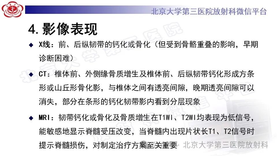 影像PPT - 【PPT】弥漫性特发性骨肥厚症-13