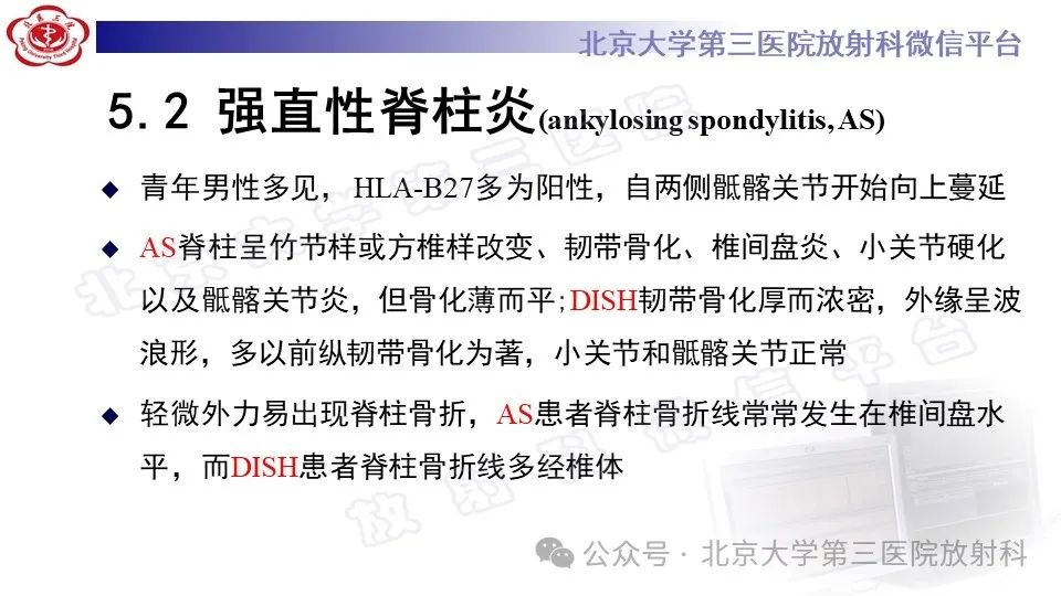 影像PPT - 【PPT】弥漫性特发性骨肥厚症-22