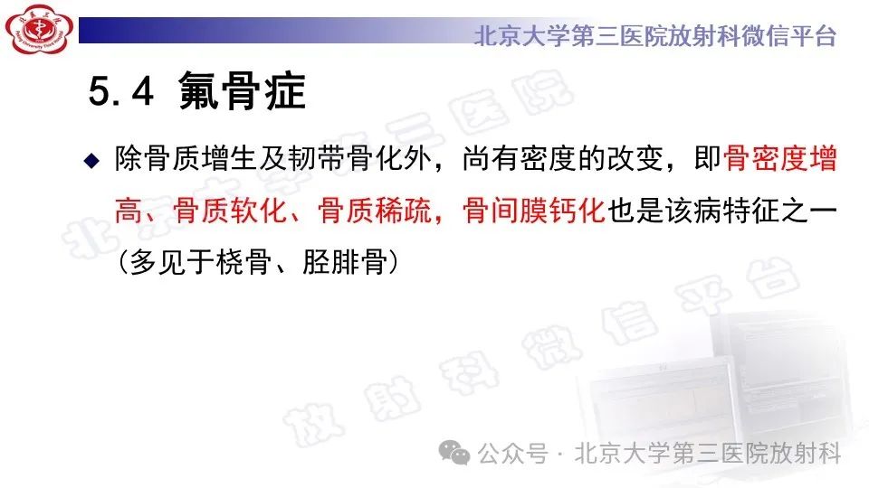 影像PPT - 【PPT】弥漫性特发性骨肥厚症-25