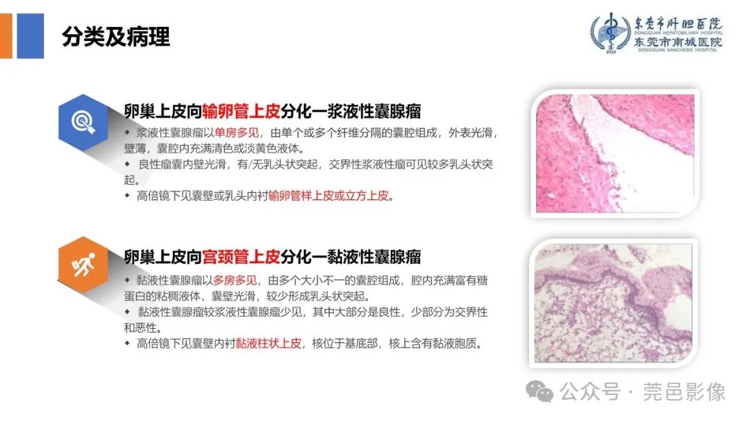 影像PPT - 【PPT】卵巢囊腺瘤MRI诊断与鉴别诊断-5