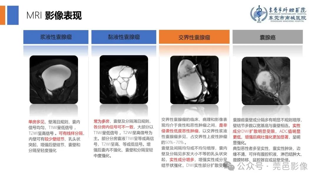 影像PPT - 【PPT】卵巢囊腺瘤MRI诊断与鉴别诊断-9