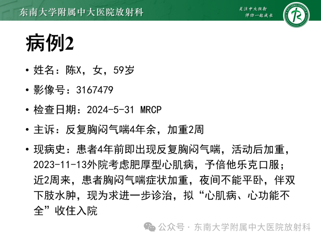 影像PPT - 【PPT】Glisson鞘水肿-4 影像PPT - 【PPT】Glisson鞘水肿-4