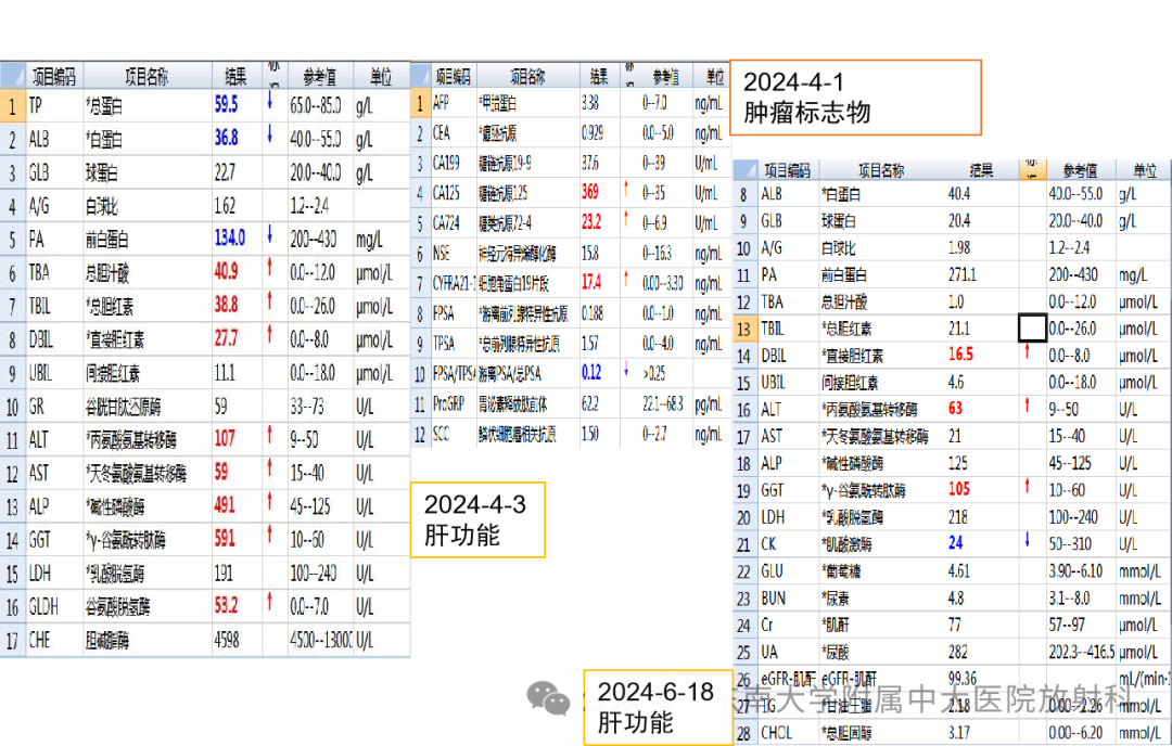 影像PPT - 【PPT】Glisson鞘水肿-2 影像PPT - 【PPT】Glisson鞘水肿-2