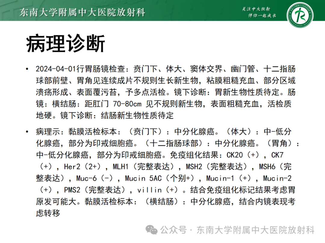 影像PPT - 【PPT】Glisson鞘水肿-3 影像PPT - 【PPT】Glisson鞘水肿-3