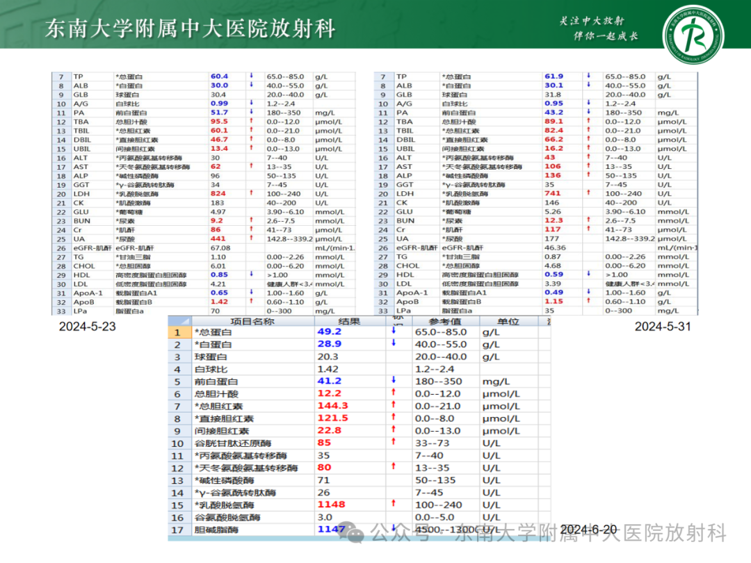 影像PPT - 【PPT】Glisson鞘水肿-6 影像PPT - 【PPT】Glisson鞘水肿-6