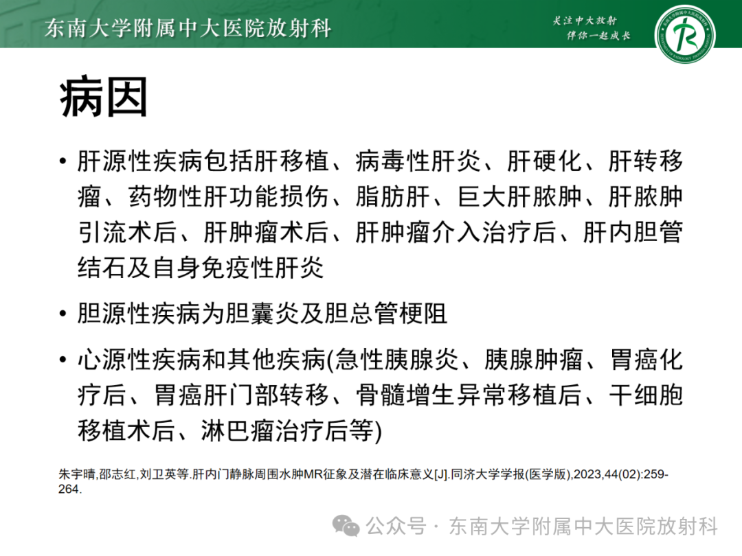 影像PPT - 【PPT】Glisson鞘水肿-27 影像PPT - 【PPT】Glisson鞘水肿-27
