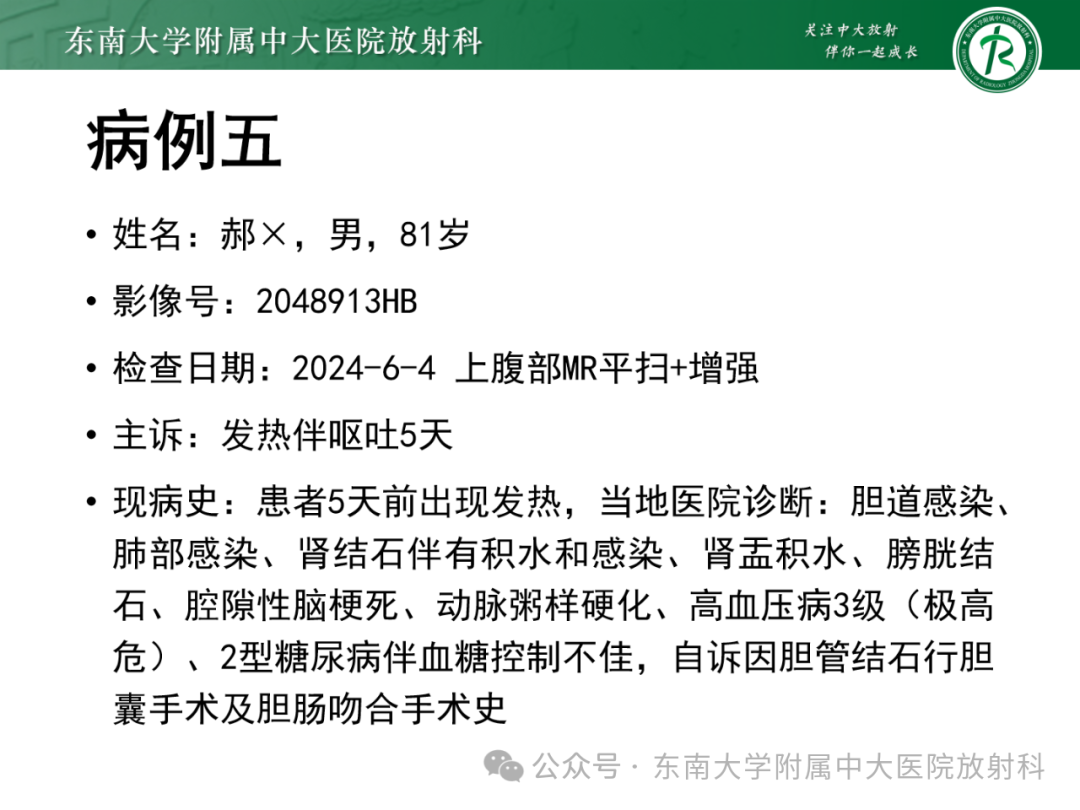 影像PPT - 【PPT】Glisson鞘水肿-36 影像PPT - 【PPT】Glisson鞘水肿-36