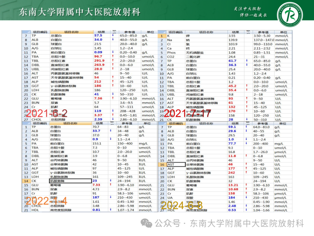 影像PPT - 【PPT】Glisson鞘水肿-38 影像PPT - 【PPT】Glisson鞘水肿-38