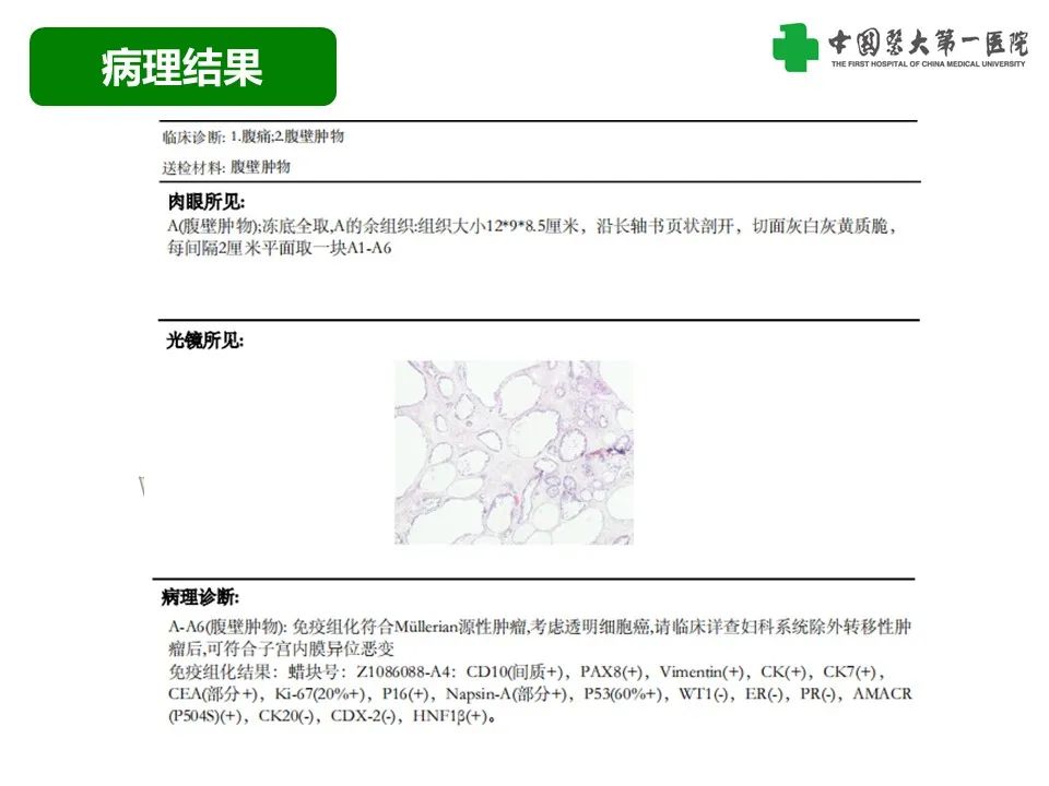 影像PPT - 【病例】腹壁子宫内膜异位症恶变-透明细胞癌-8