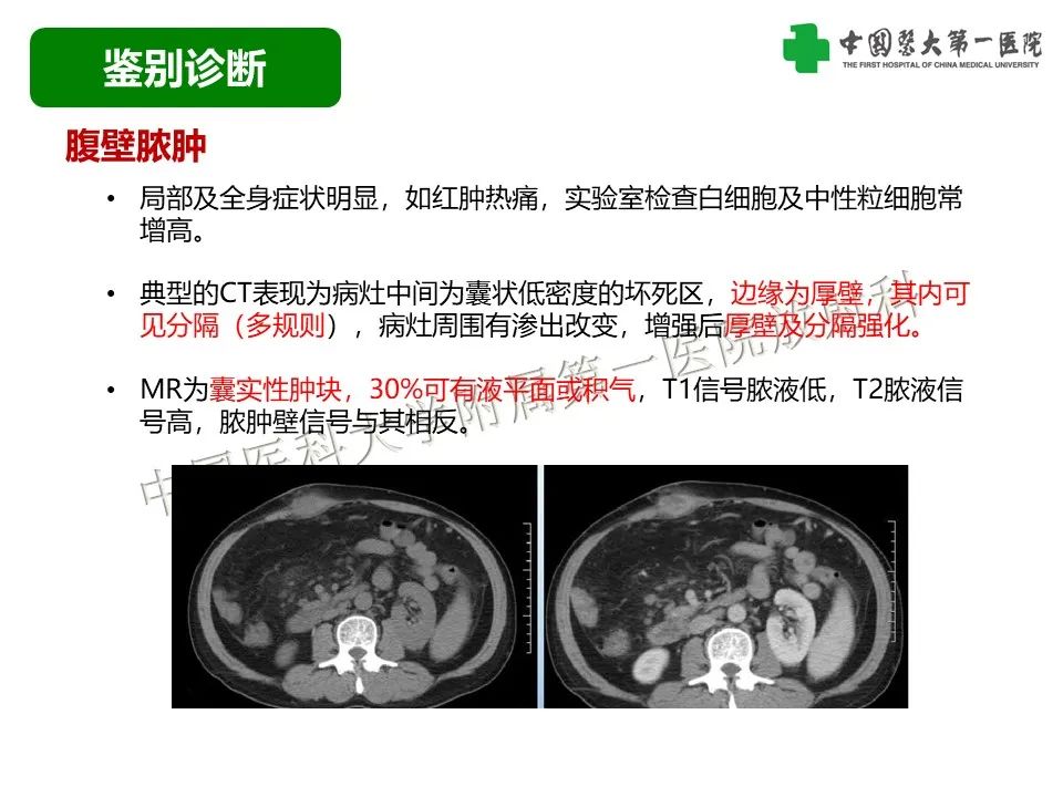影像PPT - 【病例】腹壁子宫内膜异位症恶变-透明细胞癌-39