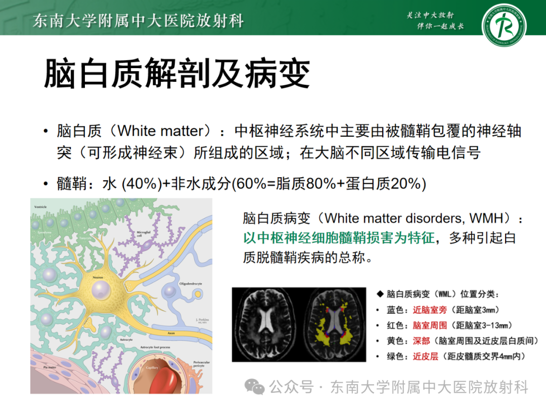 影像PPT - 【PPT】成人脑白质受累为主的弥漫/融合分布病变的诊断思路-2