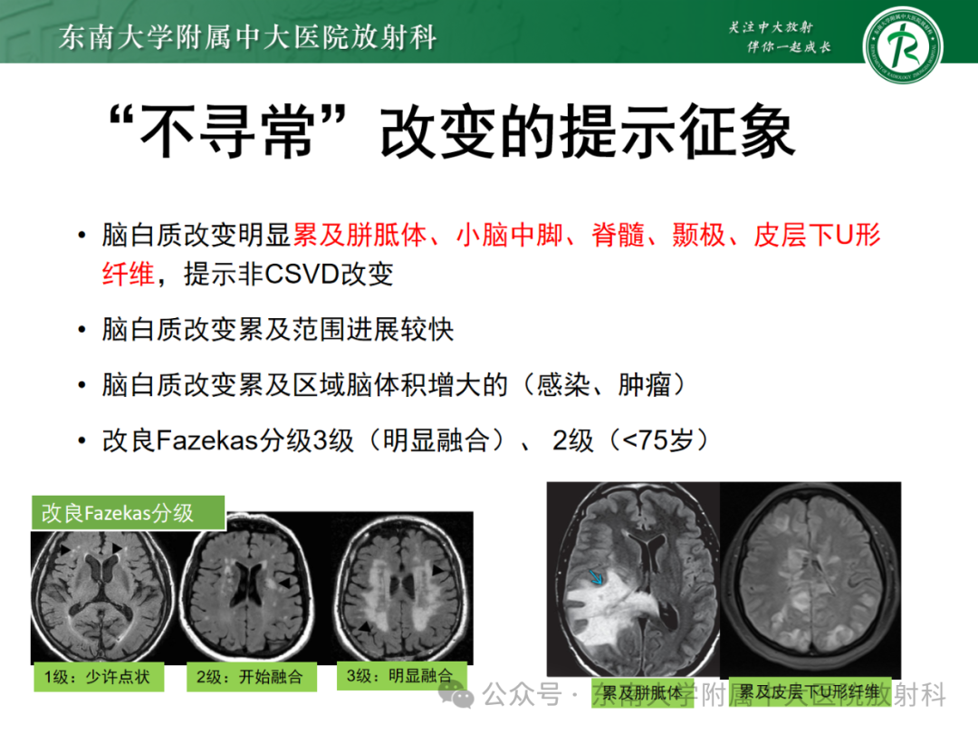 影像PPT - 【PPT】成人脑白质受累为主的弥漫/融合分布病变的诊断思路-6