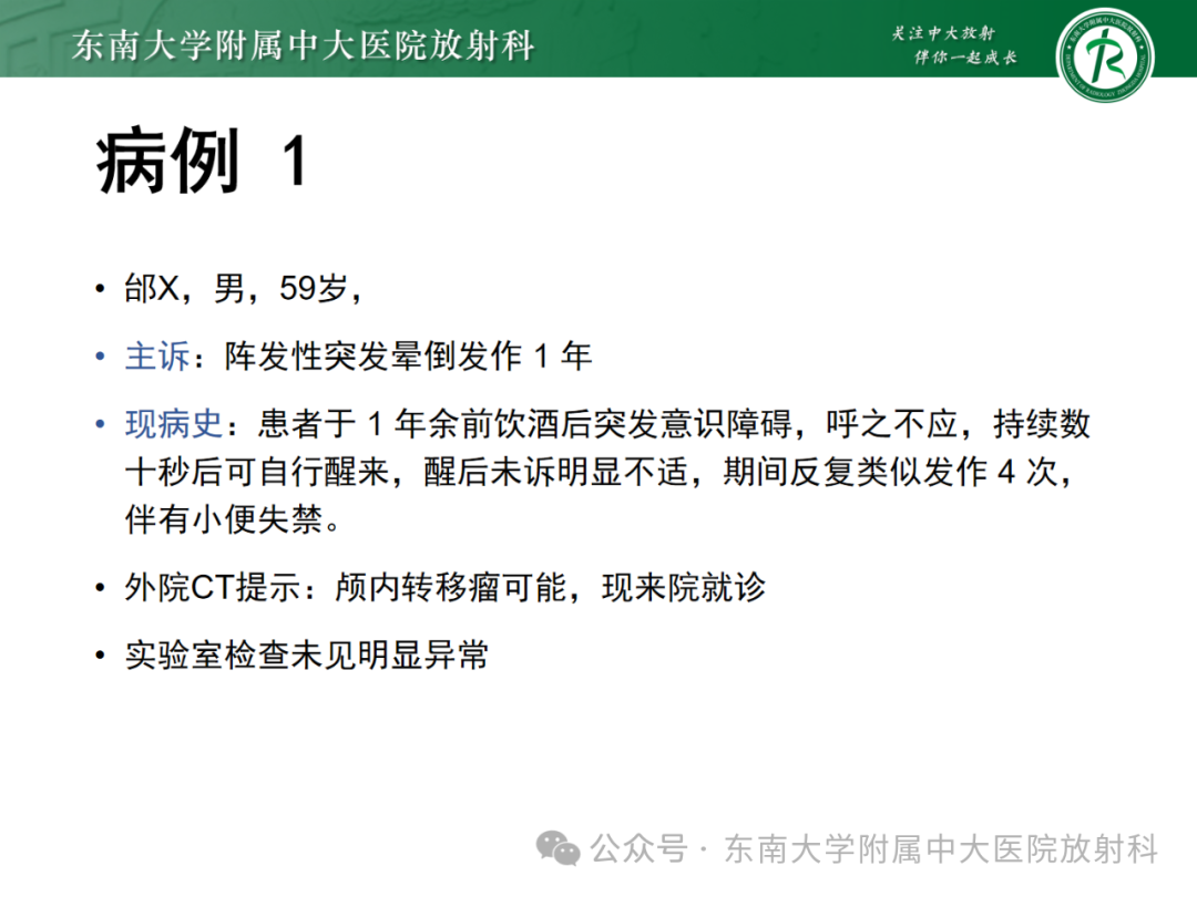 影像PPT - 【PPT】成人脑白质受累为主的弥漫/融合分布病变的诊断思路-13
