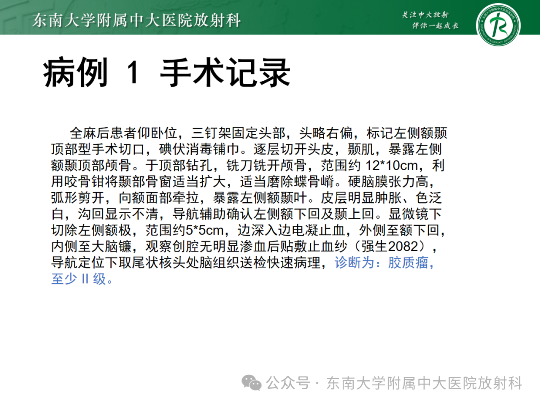 影像PPT - 【PPT】成人脑白质受累为主的弥漫/融合分布病变的诊断思路-15