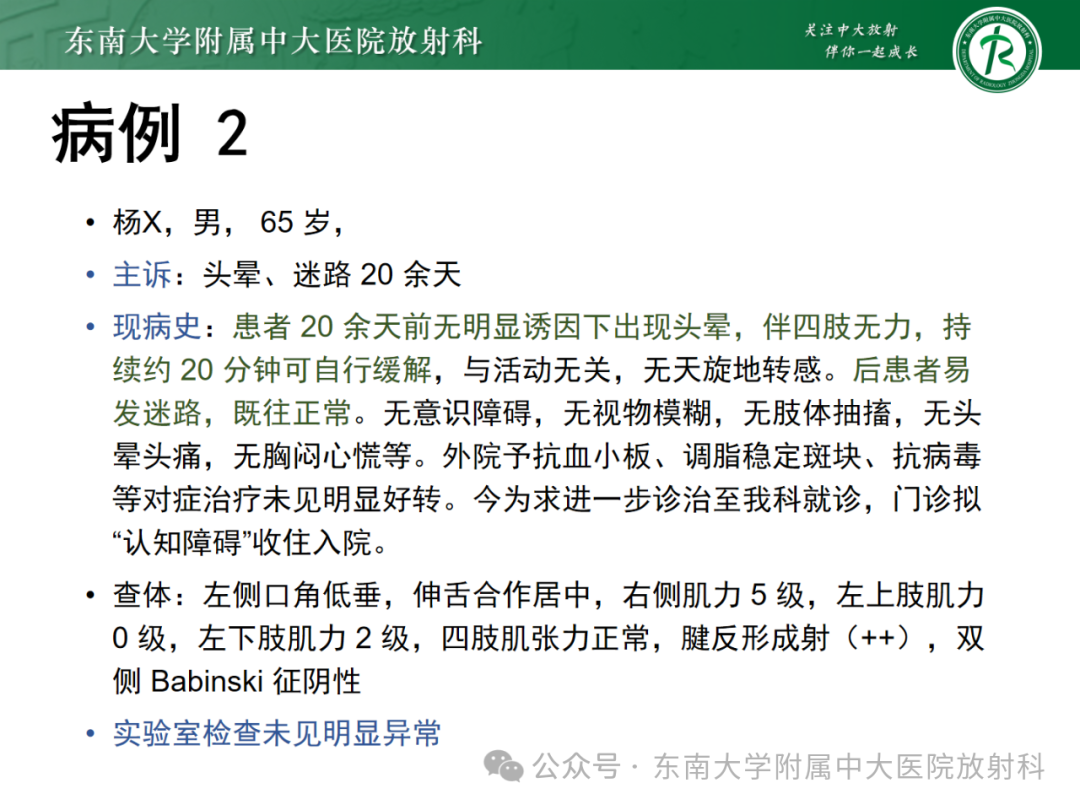 影像PPT - 【PPT】成人脑白质受累为主的弥漫/融合分布病变的诊断思路-17
