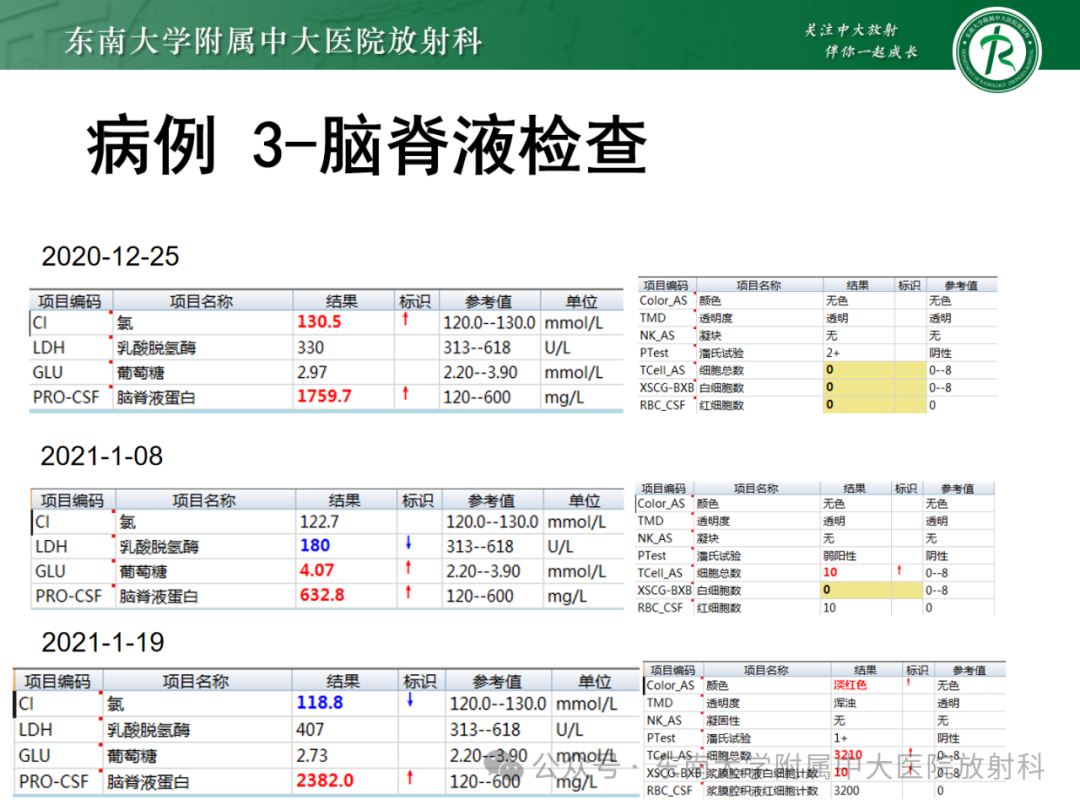 影像PPT - 【PPT】成人脑白质受累为主的弥漫/融合分布病变的诊断思路-24
