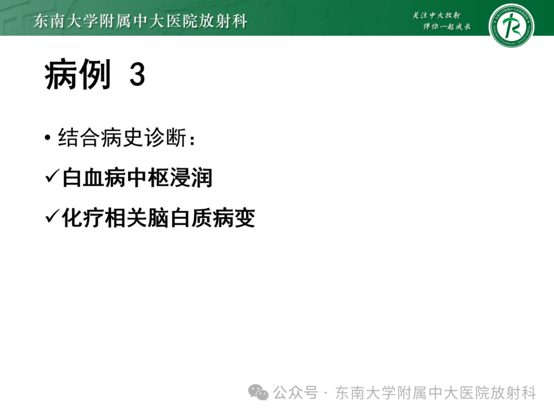 影像PPT - 【PPT】成人脑白质受累为主的弥漫/融合分布病变的诊断思路-27