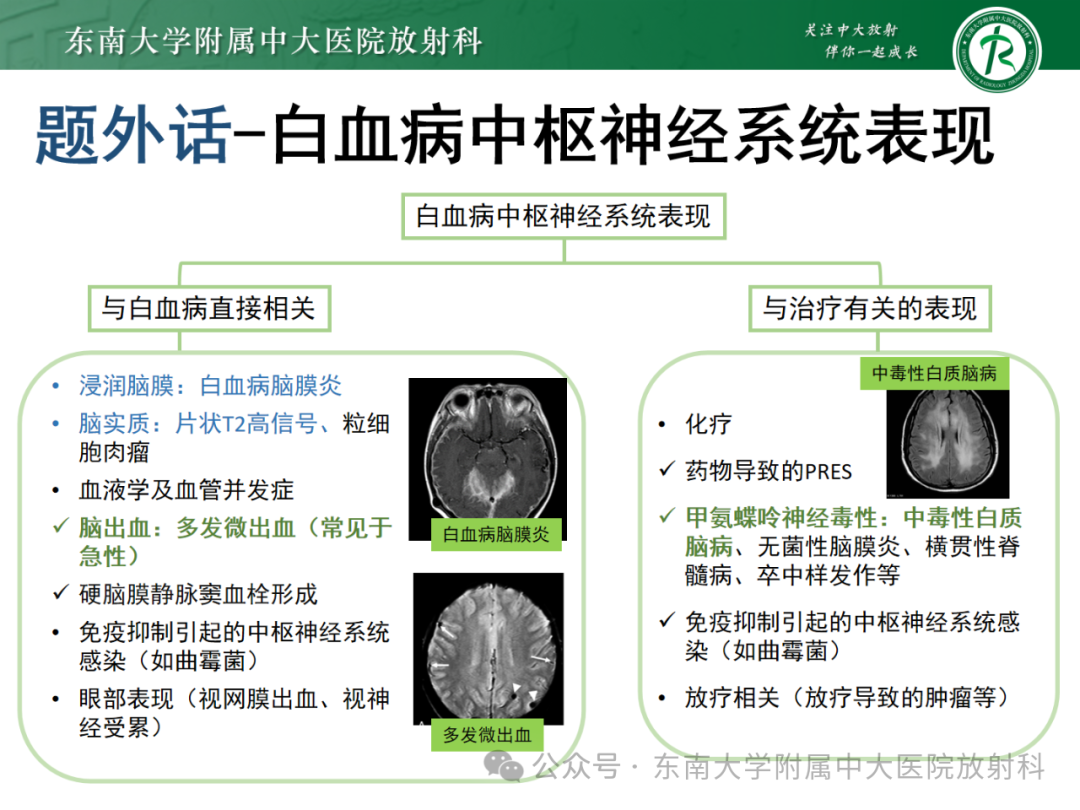 影像PPT - 【PPT】成人脑白质受累为主的弥漫/融合分布病变的诊断思路-28