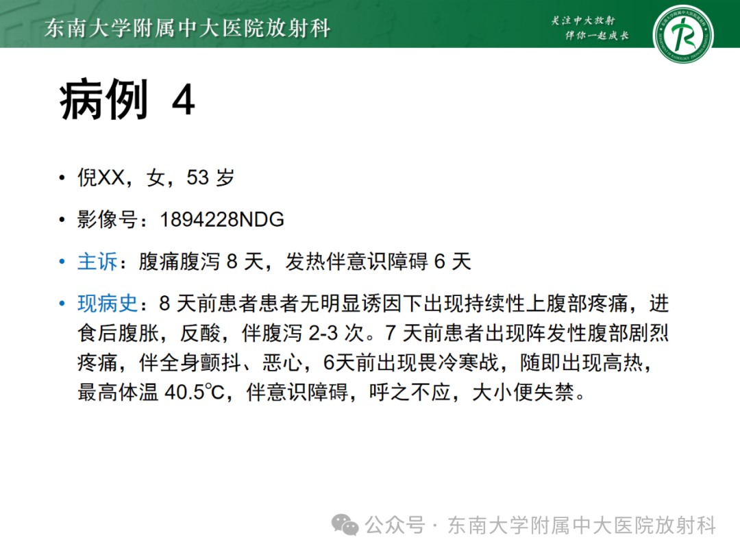 影像PPT - 【PPT】成人脑白质受累为主的弥漫/融合分布病变的诊断思路-30