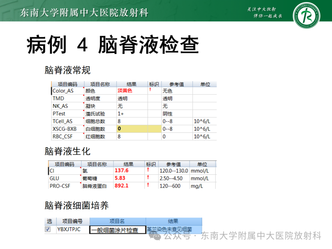 影像PPT - 【PPT】成人脑白质受累为主的弥漫/融合分布病变的诊断思路-32