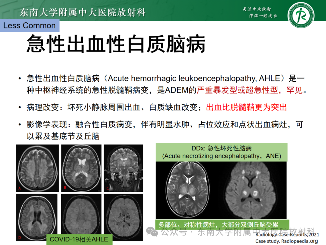 影像PPT - 【PPT】成人脑白质受累为主的弥漫/融合分布病变的诊断思路-37