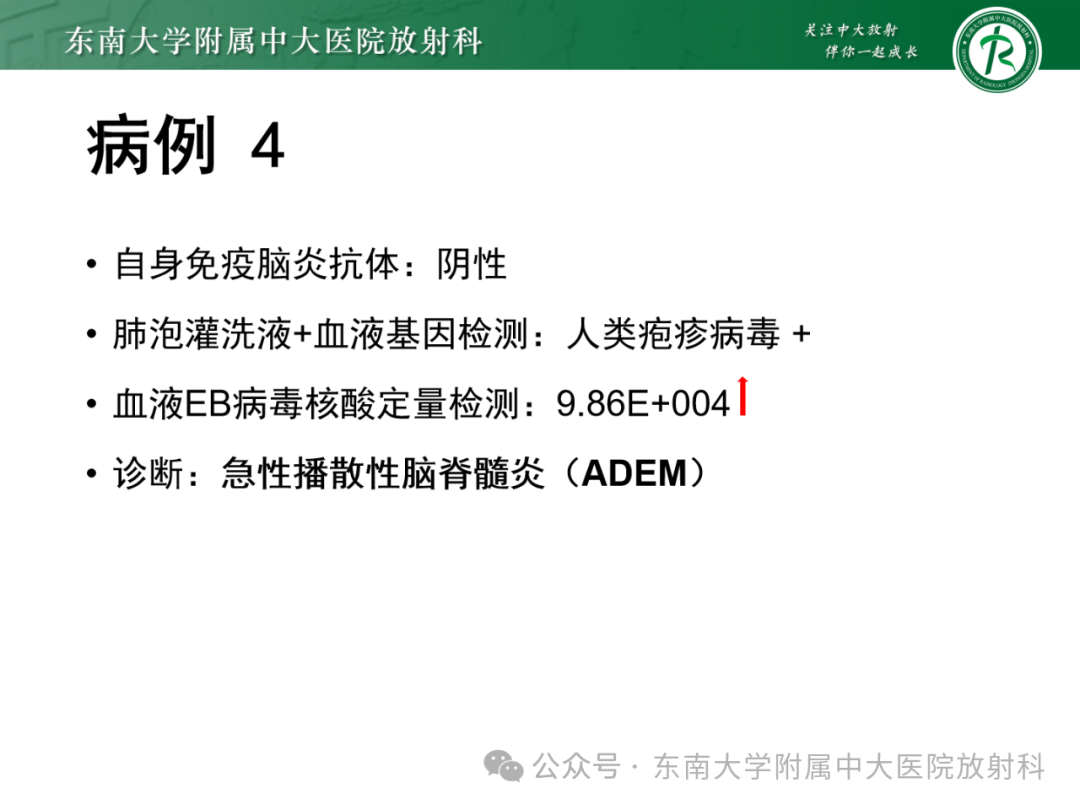 影像PPT - 【PPT】成人脑白质受累为主的弥漫/融合分布病变的诊断思路-35