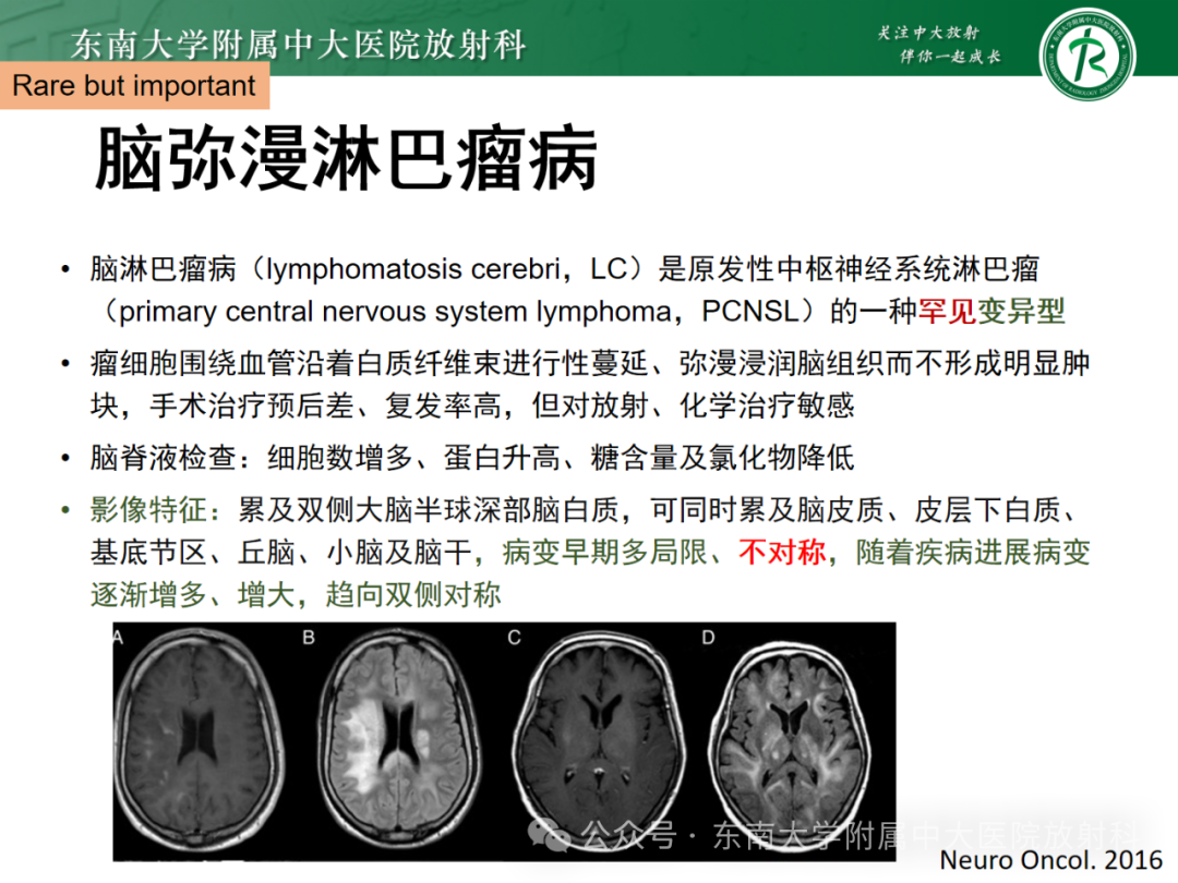 影像PPT - 【PPT】成人脑白质受累为主的弥漫/融合分布病变的诊断思路-40