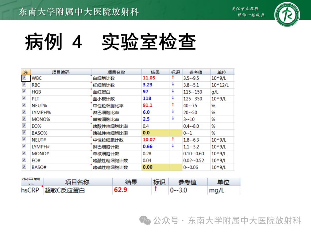 影像PPT - 【PPT】成人脑白质受累为主的弥漫/融合分布病变的诊断思路-1