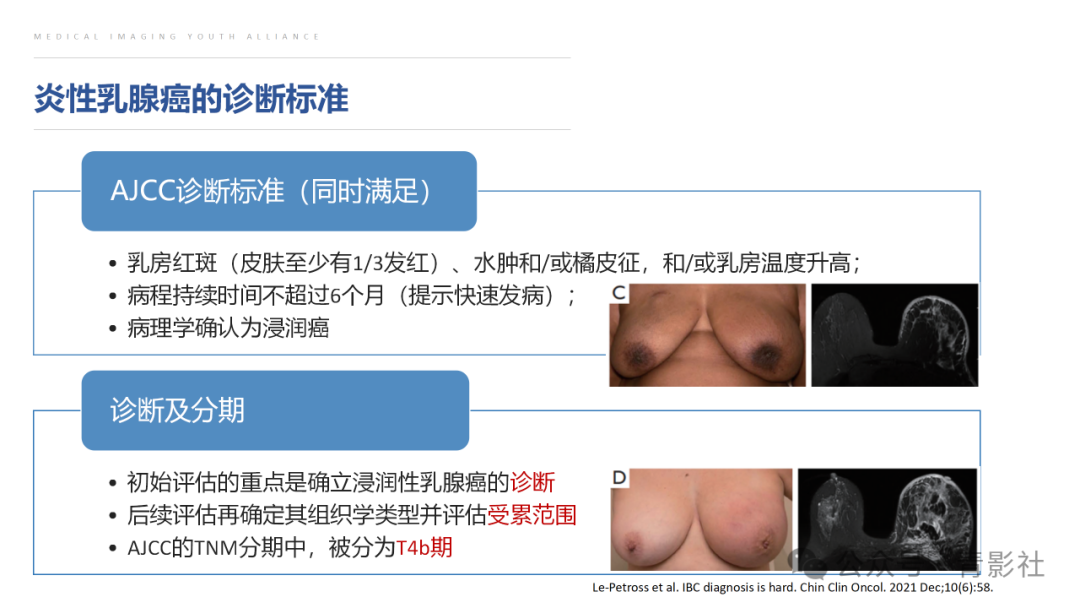 影像PPT - 【PPT】炎性乳腺癌的诊断及鉴别诊断-5