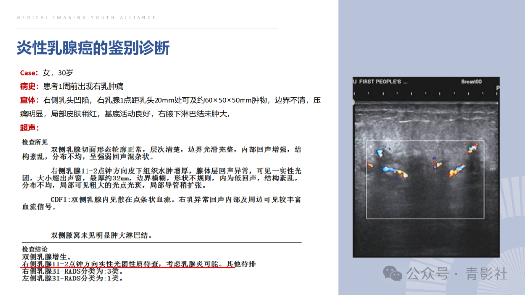 影像PPT - 【PPT】炎性乳腺癌的诊断及鉴别诊断-10