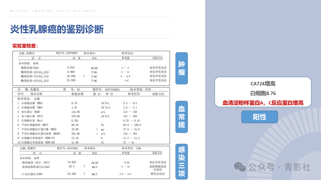 影像PPT - 【PPT】炎性乳腺癌的诊断及鉴别诊断-11