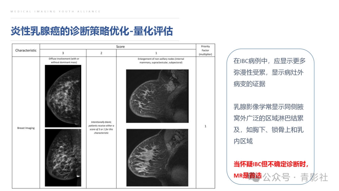 影像PPT - 【PPT】炎性乳腺癌的诊断及鉴别诊断-17