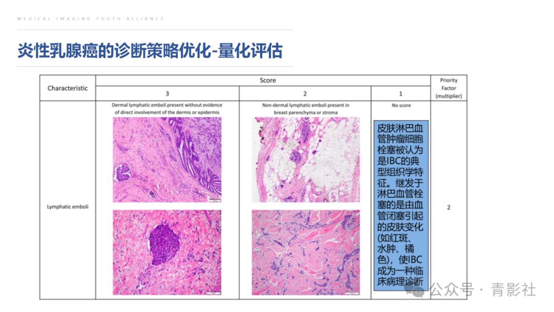 影像PPT - 【PPT】炎性乳腺癌的诊断及鉴别诊断-16