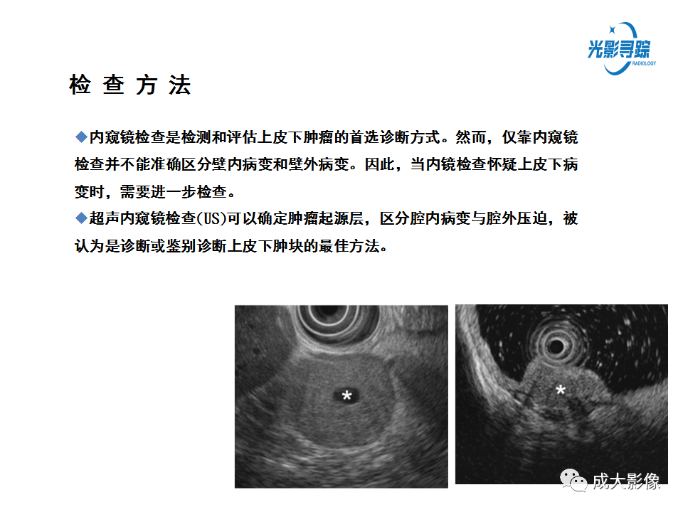 影像PPT - 【PPT】胃肠道上皮下富血供肿瘤及肿瘤样病变的CT表现-5