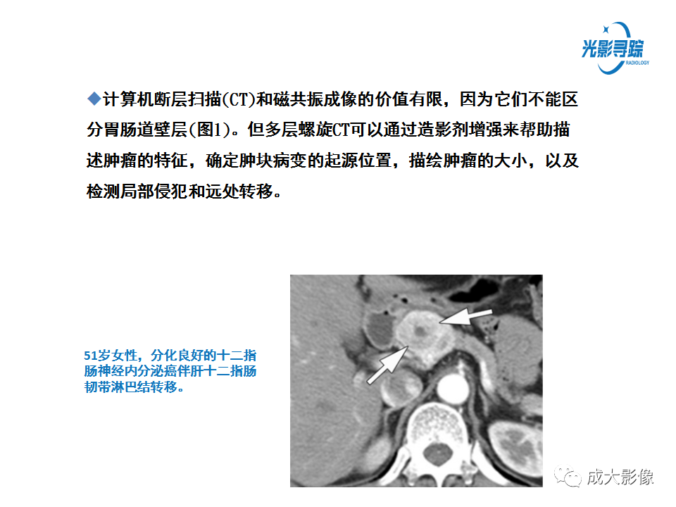 影像PPT - 【PPT】胃肠道上皮下富血供肿瘤及肿瘤样病变的CT表现-6