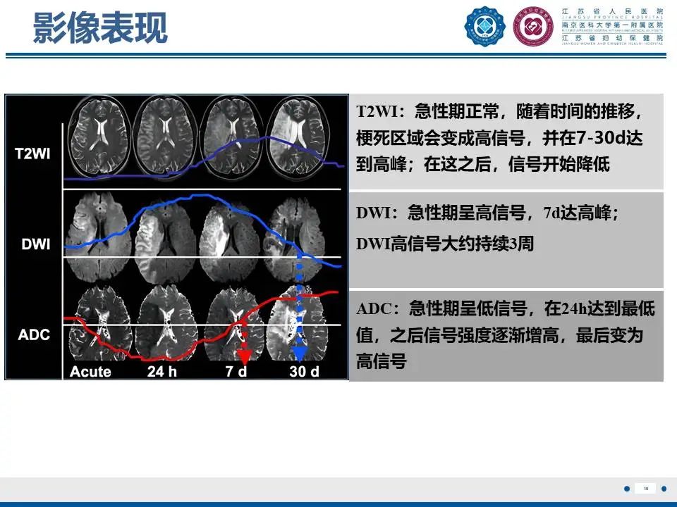 影像PPT - 【PPT】亚急性期脑梗死-19