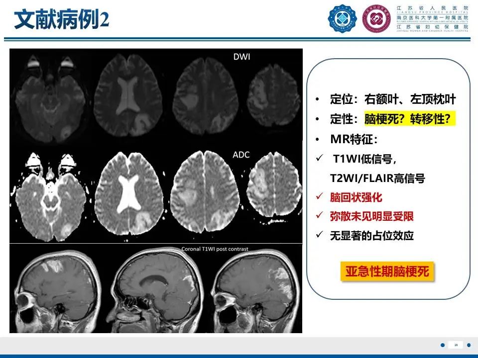 影像PPT - 【PPT】亚急性期脑梗死-28