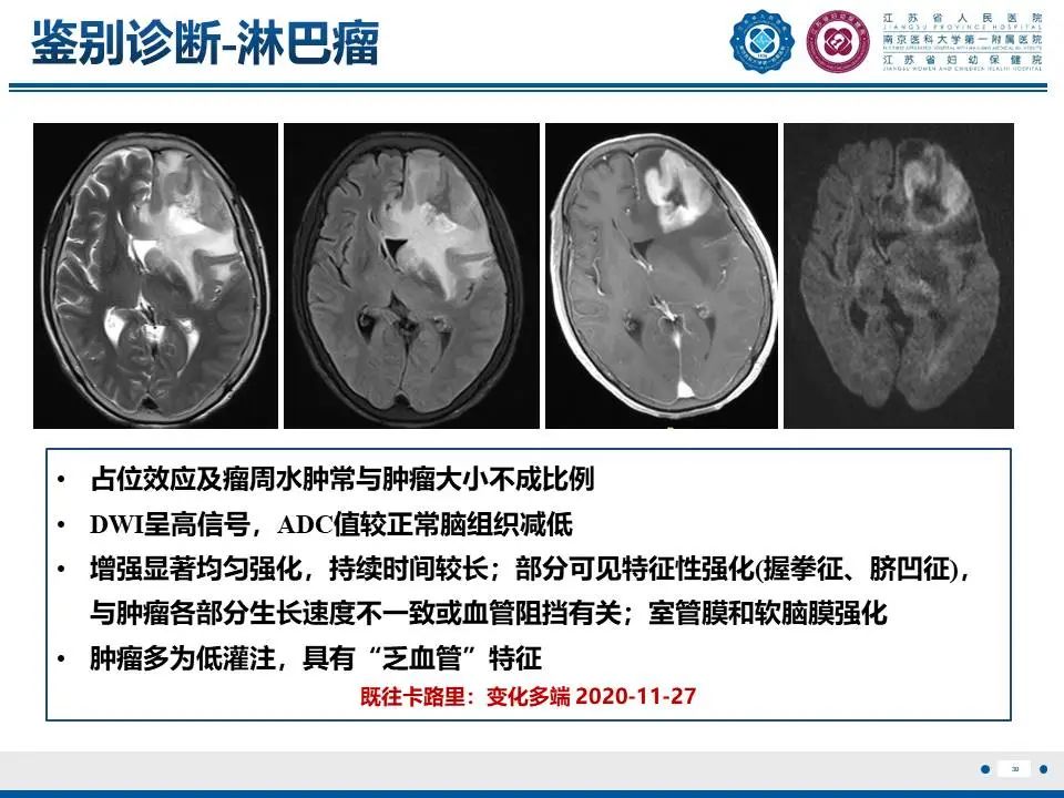影像PPT - 【PPT】亚急性期脑梗死-30