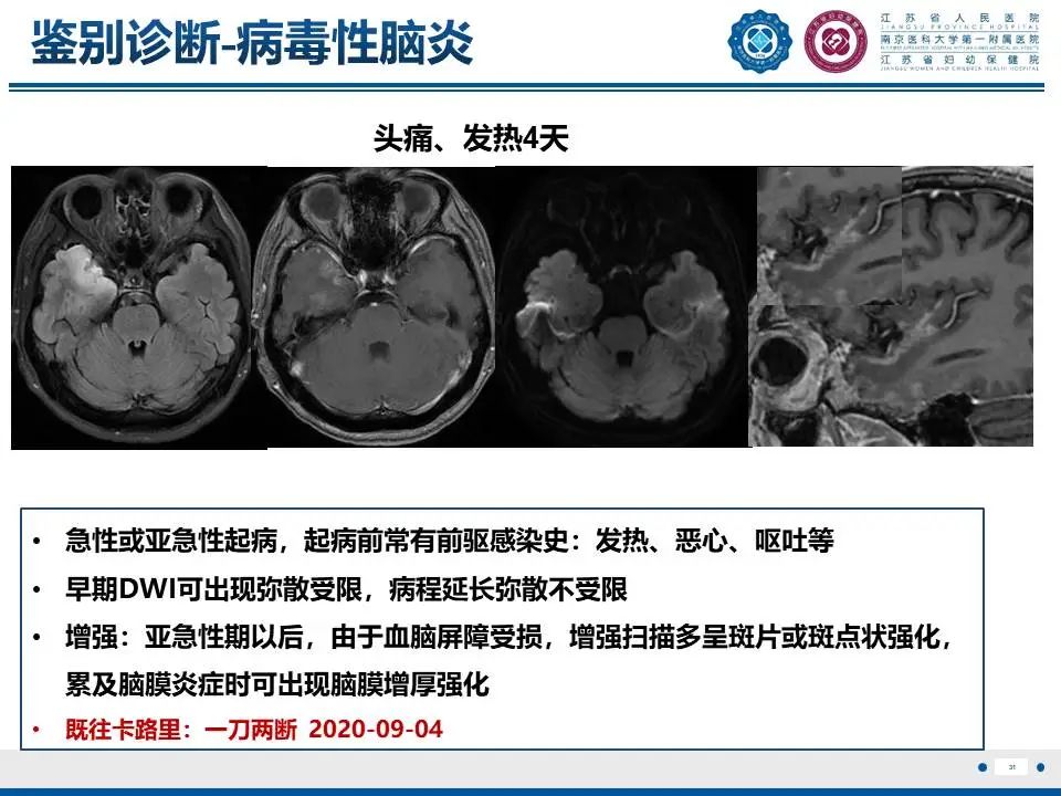 影像PPT - 【PPT】亚急性期脑梗死-31