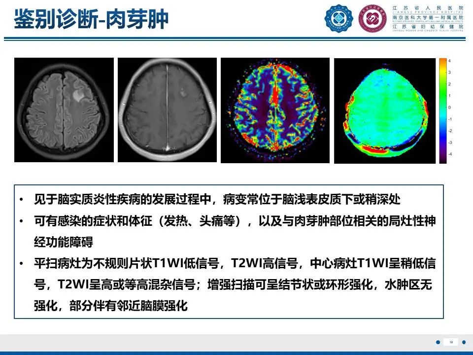 影像PPT - 【PPT】亚急性期脑梗死-32