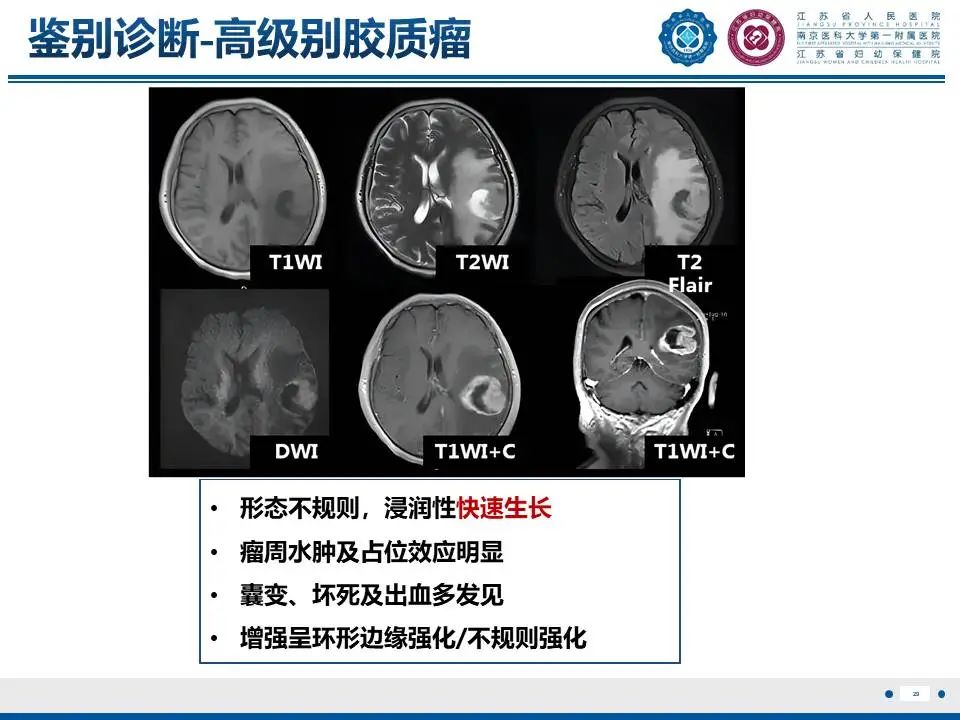 影像PPT - 【PPT】亚急性期脑梗死-29