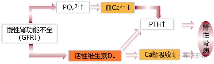 影像PPT - 肾性骨病之橄榄球衣征 (rugger-jersey spine),至今无人完美解释的骨质硬化之谜-8 影像PPT - 肾性骨病之橄榄球衣征 (rugger-jersey spine),至今无人完美解释的骨质硬化之谜-8