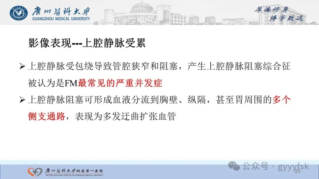 影像PPT - 【PPT】纤维素性纵隔炎-25
